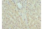 Immunohistochemistry of paraffin-embedded human liver tissue using CSB-PA008459ESR2HU at dilution 1:100