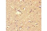 Immunohistochemistry of paraffin-embedded human brain tissue using CSB-PA008469LA01HU at dilution of 1:100