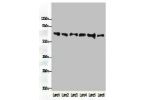 Western blot<br />
All lanes: FBXO24 antibody at 1ug/ml<br />
Lane 1 : Mouse gonadal tissue<br />
Lane 2 : Mouse kidney tissue<br />
Lane 3 : A549 whole cell lysate<br />
Lane 4 : 293T whole cell lysate<br />
Lane 5 : Jurkat whole cell lysate<br />
Lane 6
