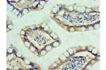 Immunohistochemistry of paraffin-embedded human small intestine using CSB-PA008525ESR2HU at dilution 1:100