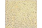 Immunohistochemistry of paraffin-embedded human tonsil tissue using CSB-PA008533LA01HU at dilution 1:100