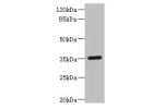 Western blot<br />
All lanes: FCGR2C antibody IgG at 1.67ug/ml+ Human Burkitt lymphoma cells<br />
Secondary<br />
Goat polyclonal to rabbit IgG at 1/10000 dilution<br />
Predicted band size: 36,31,30,26 kDa<br />
Observed band size: 36 kDa<br />