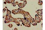 Immunohistochemistry of paraffin-embedded human placenta tissue using CSB-PA008543LA01HU at dilution of 1:100