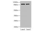 Western blot<br />
All lanes: FCHSD2 antibody at 12ug/ml<br />
Lane 1 : U251 whole cell lysate<br />
Lane 2 : A549 whole cell lysate<br />
Secondary<br />
Goat polyclonal to Rabbit IgG at 1/10000 dilution<br />
Predicted band size: 85,78,59 kDa<br />
Obse