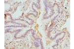 Immunohistochemistry of paraffin-embedded Human lung tissue using CSB-PA008550ESR1HU at dilution 1:100
