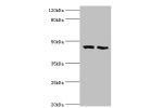 All lanes:Squalene synthase antibody at 2ug/ml<br />
Lane 1:293T whole cell lysate<br />
Lane 2:mouse liver tissue<br />
Secondary<br />
Goat polyclonal to rabbit at 1/10000 dilution<br />
Predicted band size: 49,41,39,36,44 kDa<br />
Observed band size: 