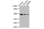 Western Blot<br />
Positive WB detected in:HepG2 whole cell lysate,SH-SY5Y whole cell lysate,HEK293 whole cell lysate<br />
All lanes:FDFT1 antibody at 3