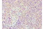 Immunohistochemistry of paraffin-embedded human tonsil using CSB-PA008597ESR1HU at dilution 1:100