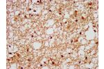 IHC image of CSB-PA008604LA01HU diluted at 1:400 and staining in paraffin-embedded human brain tissue performed on a Leica BondTM system. After dewaxing and hydration, antigen retrieval was mediated by high pressure in a citrate buffer (pH 6.0). Section w