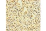 Immunohistochemistry of paraffin-embedded human spleen tissue using CSB-PA008605LA01HU at dilution of 1:100