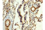 IHC image of CSB-PA008608LA01HU diluted at 1:400 and staining in paraffin-embedded human lung tissue performed on a Leica BondTM system. After dewaxing and hydration, antigen retrieval was mediated by high pressure in a citrate buffer (pH 6.0). Section wa
