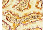 Immunohistochemistry of paraffin-embedded human small intestine using CSB-PA008619ESR2HU at dilution 1:100