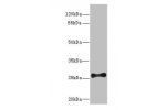 Western blot<br />
All lanes: FGF13 antibody IgG at 12ug/ml+ Mouse brain tissue<br />
Secondary<br />
Goat polyclonal to rabbit IgG at 1/10000 dilution<br />
Predicted band size: 28,22,29,23,26 kDa<br />
Observed band size: 28 kDa<br />