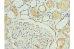 Immunohistochemistry of paraffin-embedded human kidney tissue using CSB-PA008624ESR1HU at dilution 1:100