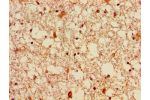 Immunohistochemistry of paraffin-embedded human brain tissue using CSB-PA008628LA01HU at dilution of 1:100