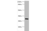 Western blot<br />
All lanes: Fibroblast growth factor 23 antibody at 2ug/ml+rat heart tissue<br />
Secondary<br />
Goat polyclonal to rabbit at 1/10000 dilution<br />
Predicted band size: 28kDa<br />
Observed band size: 28kDa<br />