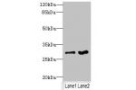Western blot<br />
All lanes: FGFR1OP2 antibody at 6ug/ml<br />
Lane 1 : Mouse gonadal tissue<br />
Lane 2 : Human placenta tissue<br />
Secondary<br />
Goat polyclonal to Rabbit IgG at 1/10000 dilution<br />
Predicted band size: 30,25,21 kDa<br />
Observ