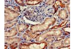 Immunohistochemistry of paraffin-embedded human kidney tissue using CSB-PA008651LA01HU at dilution of 1:100