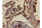 Immunohistochemistry of paraffin-embedded human lung tissue using CSB-PA008655LA01HU at dilution of 1:100