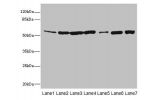 Western blot<br />
All lanes: FH antibody at 12ug/ml<br />
Lane 1 : Mouse heart tissue<br />
Lane 2 : Mouse liver tissue<br />
Lane 3 : Mouse kidney tissue<br />
Lane 4 : Mouse brain tissue<br />
Lane 5 : Human placenta tissue<br />
Lane 6 : Hela whole ce