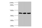 Western blot<br />
All lanes:FIBP antibody at 1.84ug/ml<br />
Lane 1:rat gonad tissue<br />
Lane 2:MCF-7 whole cell lysate<br />
Lane 3:mouse skeletal muscle tissue<br />
Secondary<br />
Goat polyclonal to rabbit at 1/10000 dilution<br />
Predicted band s