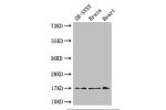 Western Blot<br />
Positive WB detected in:SH-SY5Y whole cell lysate,Mouse brain tissue,Mouse heart tissue<br />
All lanes: FIS1 antibody at 3ug/ml<br />
Secondary<br />
Goat polyclonal to rabbit IgG at 1/50000 dilution<br />
Predicted band size: 17 kDa<b