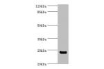 Western blot<br />
All lanes:Peptidyl-prolyl cis-trans isomerase FKBP3 antibody at 2ug/ml+mouse brain tissue<br />
Secondary<br />
Goat polyclonal to rabbit at 1/10000 dilution<br />
Predicted band size: 25kDa<br />
Observed band size: 25kDa<br />