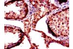 Immunohistochemistry of paraffin-embedded human testis tissue using CSB-PA008702LA01HU at dilution of 1:100