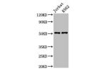 Western Blot<br />
Positive WB detected in:Jurkat whole cell lysate,K562 whole cell lysate<br />
All lanes:FLI1 antibody at 3