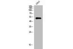 Western Blot analysis of COLO cells using GATA-4 Polyclonal Antibody