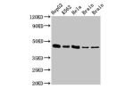 Western Blot<br />
Positive WB detected in:HepG2 whole cell lysate,K562 whole cell lysate,Hela whole cell lysate,Rat brain tissue,Mouse brain tissue<br />
All lanes:FLOT1 antibody at 3