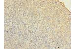Immunohistochemistry of paraffin-embedded human tonsil tissue using CSB-PA008743LA01HU at dilution of 1:100