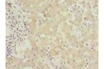 Immunohistochemistry of paraffin-embedded human liver tissue using CSB-PA008750LA01HU at dilution of 1:100