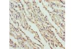 Immunohistochemistry of paraffin-embedded human lung tissue using CSB-PA008751ESR1HU at dilution 1:100