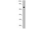 Western blot<br />
All lanes:FMO5 antibody at 6.04 ug/ml<br />
 +Mouse liver tissue<br />
Secondary<br />
Goat polyclonal to rabbit IgG at 1/10000 dilution<br />
Predicted band size: 61,33,53 kDa<br />
Observed band size: 60 kDa<br />