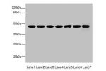 Western blot<br />
All lanes: FNTB antibody at 6ug/ml<br />
Lane 1 : Hela whole cell lysate<br />
Lane 2 : CEM whole cell lysate<br />
Lane 3 : HepG-2 whole cell lysate<br />
Lane 4 : SH-SY5Y whole cell lysate<br />
Lane 5 : U87 whole cell lysate<br />
La