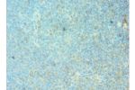 Immunohistochemistry of paraffin-embedded human tonsil using CSB-PA008792DSR1HU at dilution 1:100