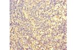 Immunohistochemistry of paraffin-embedded human tonsil tissue using CSB-PA008793HA01HU at dilution of 1:100