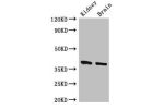 Western Blot<br />
Positive WB detected in:Mouse kidney tissue,Mouse brain tissue<br />
All lanes:FOXE1 antibody at 2.4