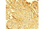 Immunohistochemistry of paraffin-embedded human heart tissue using CSB-PA008815HA01HU at dilution 1:100