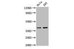 Western Blot<br />
Positive WB detected in:Hela whole cell lysate,293 whole cell lysate<br />
All lanes:FOXH1 antibody at 2.7
