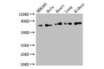 Western Blot<br />
Positive WB detected in:HEK293 whole cell lysate,Hela whole cell lysate,Mouse heart tissue,Mouse lung tissue,Mouse kidney tissue<br />
All lanes:FOXK1 antibody at 2.5ug/ml<br />
Secondary<br />
Goat polyclonal to rabbit IgG at 1/50000 d