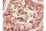 Immunohistochemistry of paraffin-embedded human testis tissue using CSB-PA008828HA01HU at dilution of 1:100