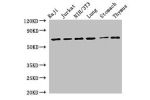 Western Blot<br />
Positive WB detected in:Raji whole cell lysate,Jurkat whole cell lysate,NIH/3T3 whole cell lysate,Mouse lung tissue,Mouse stomach tissue,Rat thymus tissue<br />
All lanes:FOXN1 antibody at 2.7