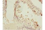 Immunohistochemistry of paraffin-embedded human testis tissue using CSB-PA008830ESR1HU at dilution 1:100