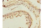 Immunohistochemistry of paraffin-embedded human testis tissue using CSB-PA008830ESR2HU at dilution 1:100