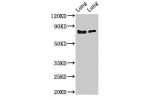 Western Blot<br />
Positive WB detected in:Rat lung tissue,Mouse lung tissue<br />
All lanes:FOXP1 antibody at 2