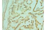 Immunohistochemistry of paraffin-embedded human prostate using CSB-PA008842DSR1HU at dilution 1:100