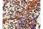 Immunohistochemistry of paraffin-embedded human tonsil tissue using CSB-PA008856LA01HU at dilution of 1:100