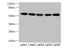 Western blot<br />
All lanes: